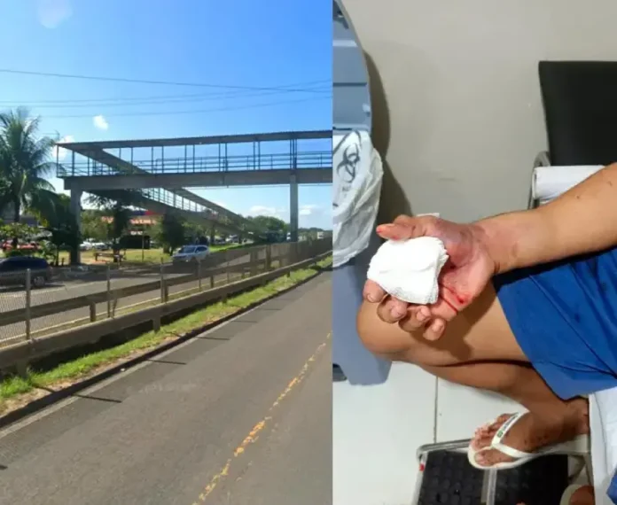 Ele recebeu atendimento e passa bem.